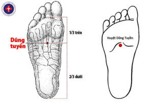 Xoa bóp bấm huyệt điều trị mất ngủ tại nhà với huyệt dũng tuyền